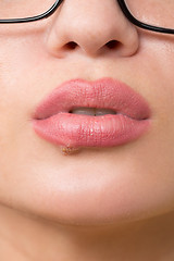 Image showing beautiful lips virus infected herpes