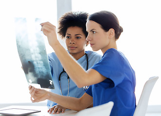 Image showing doctors with x-ray image of spine at hospital