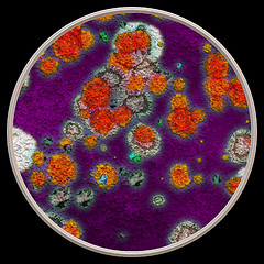 Image showing Lichen and fungi under microscope