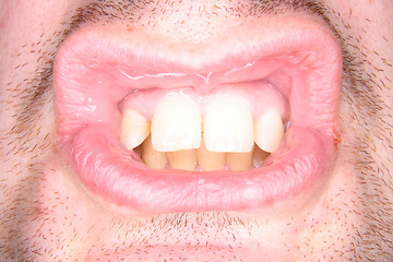 Image showing teeth