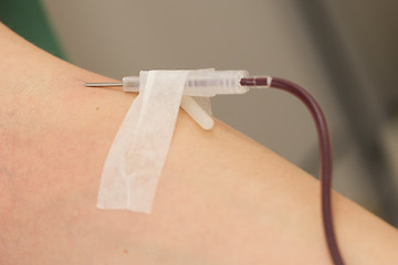 Image showing Donor in an armchair donates blood,, close-up