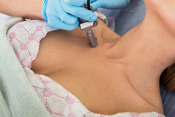 Image showing fractional laser rejuvenation