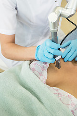 Image showing fractional laser rejuvenation