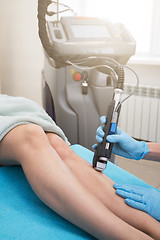 Image showing laser legs epilation