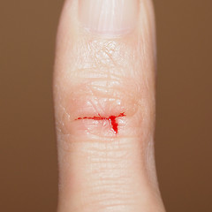 Image showing Paper cut with blood