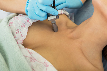 Image showing fractional laser rejuvenation