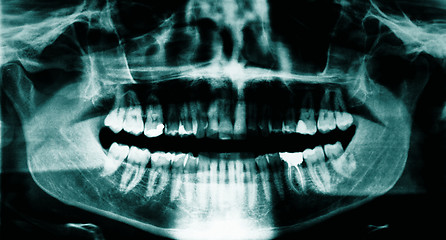 Image showing Dental x-ray