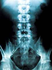 Image showing x-ray of a young male spine