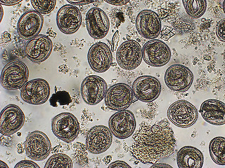 Image showing Toxocara cati L-2 larvae in eggs microscope