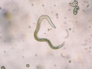 Image showing Toxocara canis second stage larvae hatch from eggs