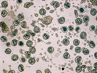 Image showing Toxocara canis embryonated egg with larva