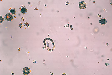 Image showing Toxocara canis and embryonated egg with larva