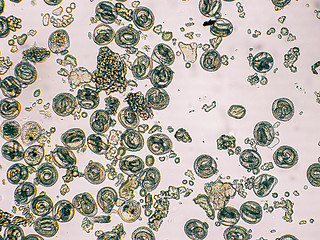 Image showing Toxocara canis embryonated egg with larva