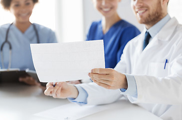 Image showing close up of doctors with cardiogram at hospital 