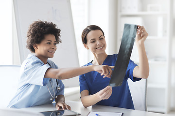 Image showing happy female doctors with x-ray image at hospital