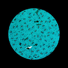 Image showing Stoma micrograph