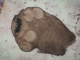 Image showing Multiceps multiceps protoscoleces