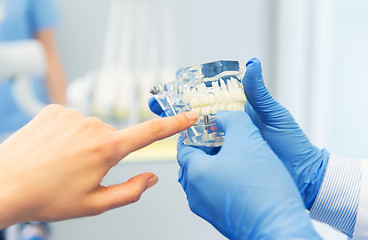 Image showing close up of dentist hands with teeth or jaw model