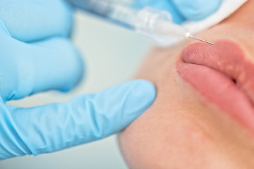 Image showing woman gets injection in her lips