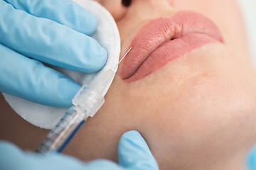 Image showing woman gets injection in her lips