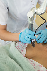 Image showing fractional laser rejuvenation