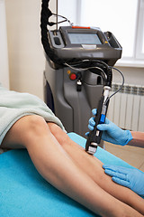 Image showing laser legs epilation