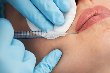 Image showing woman gets injection in her lips