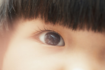 Image showing Vision of child