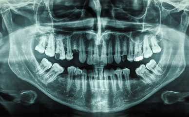 Image showing Human teeth xray