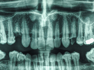 Image showing Human teeth xray