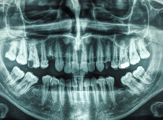 Image showing Human teeth xray