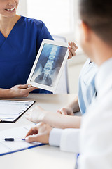 Image showing close up of happy doctors with x-ray at hospital