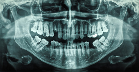 Image showing Human teeth xray