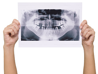 Image showing panoramic x-ray skan