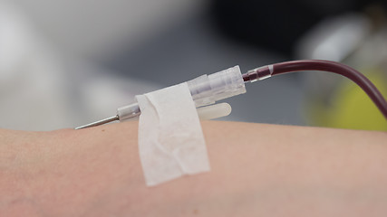 Image showing Donor in an armchair donates blood,, close-up