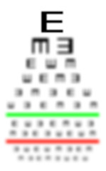 Image showing Eyesight concept - Really bad eyesight