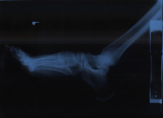 Image showing x-ray