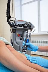 Image showing laser legs epilation