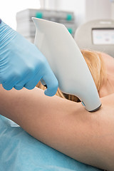 Image showing Procedure against hyperhidrosis