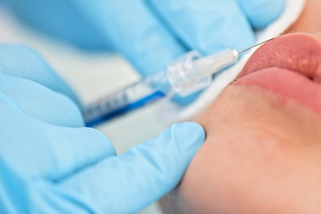 Image showing woman gets injection in her lips