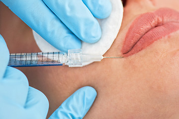 Image showing woman gets injection in her lips