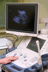 Image showing medical examining pregnant belly by ultrasonic scan of a baby on