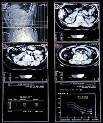 Image showing health medical scan