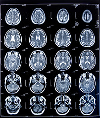 Image showing health medical mri