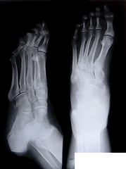 Image showing health medical x ray