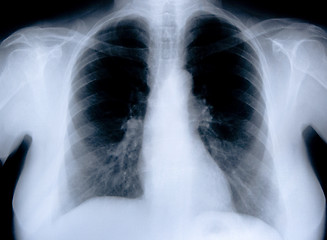 Image showing health medical x ray