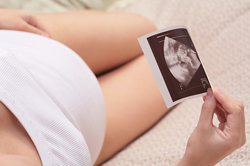 Image showing pregnancy, ultrasonic portrait of the fetus