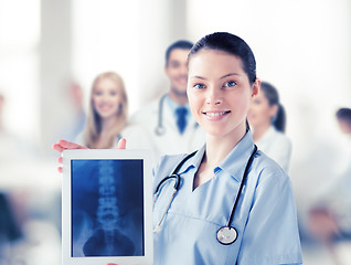 Image showing female doctor with x-ray on tablet pc