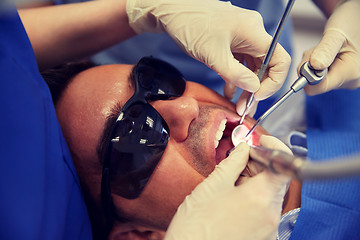 Image showing dentist hands treating male patient teeth