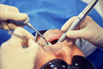 Image showing dentist hands treating male patient teeth